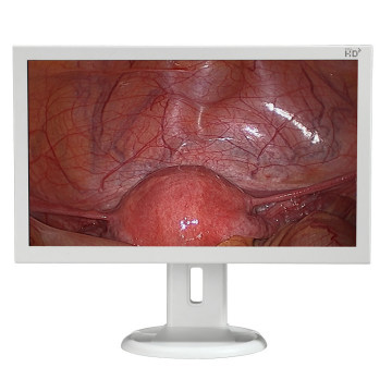 Moniteur chirurgical d&#39;endoscopie HD 21,5 &quot;